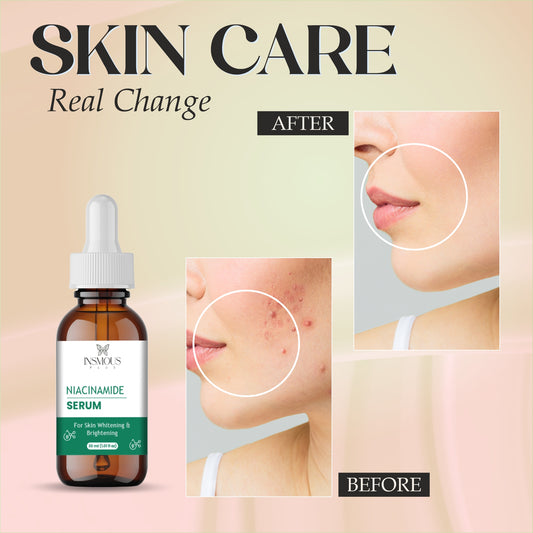 Niacinamide Serum 10% + Zinc 1% – Face Serum for Pore Minimizing, Oil Control & Even Skin Tone – Hydrating Anti-Aging Formula for Oily, Acne-Prone & Sensitive Skin