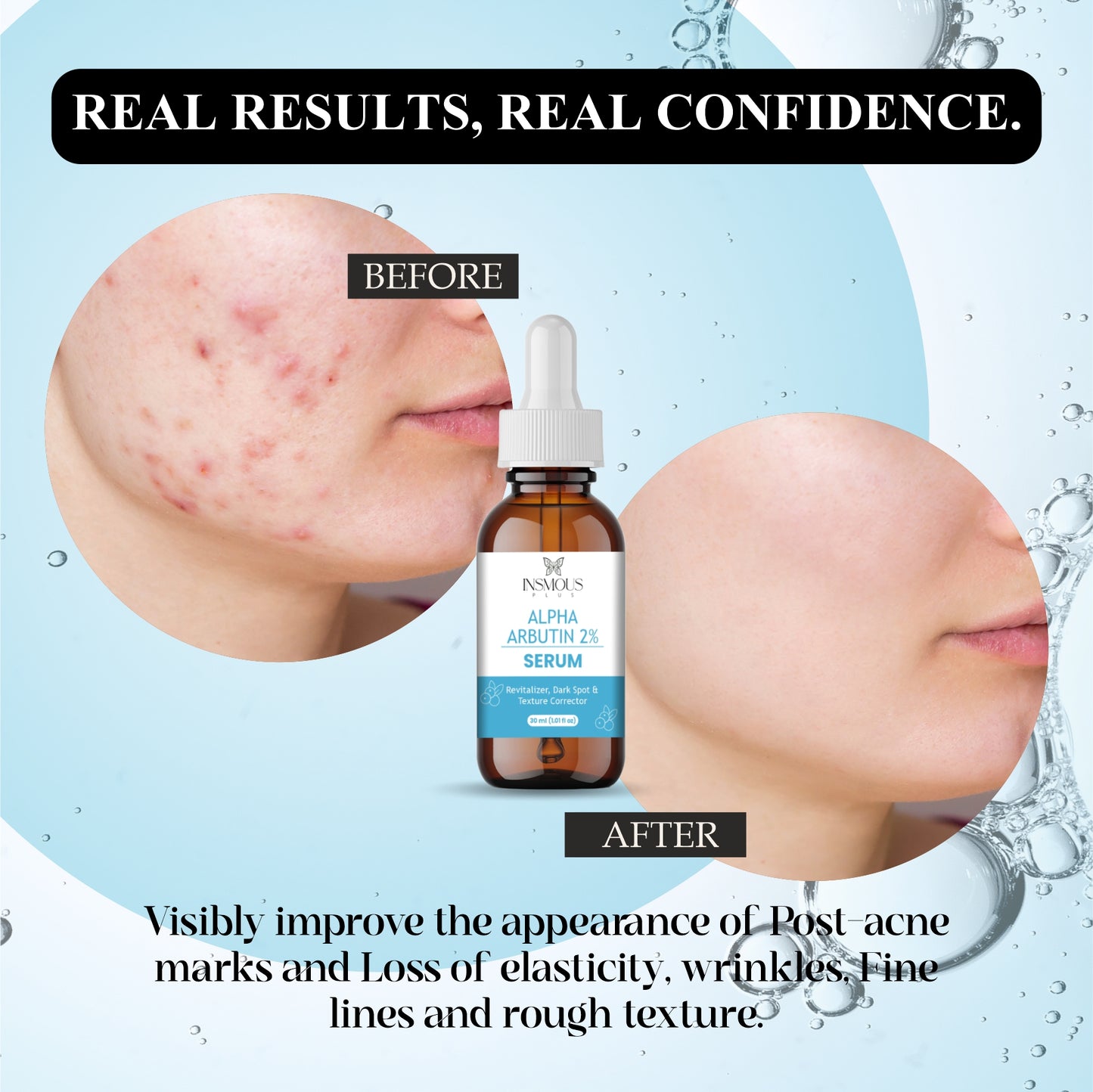 2% Alpha Arbutin Serum for Face – Dark Spot Corrector, Hyperpigmentation Treatment, Skin Brightening & Even Tone – Lightweight, Hydrating Formula with Hyaluronic Acid – 30ml