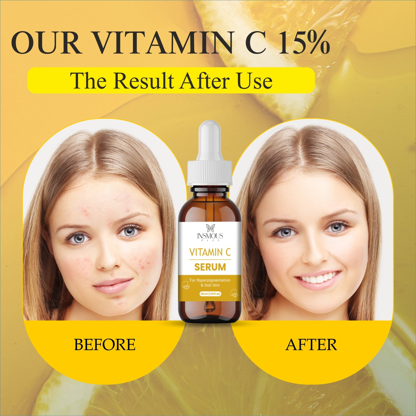 Vitamin C Serum for Face – Anti-Aging & Brightening Facial Serum with Hyaluronic Acid, Vitamin E & Ferulic Acid – Dark Spot Corrector, Wrinkle & Fine Line Reducer
