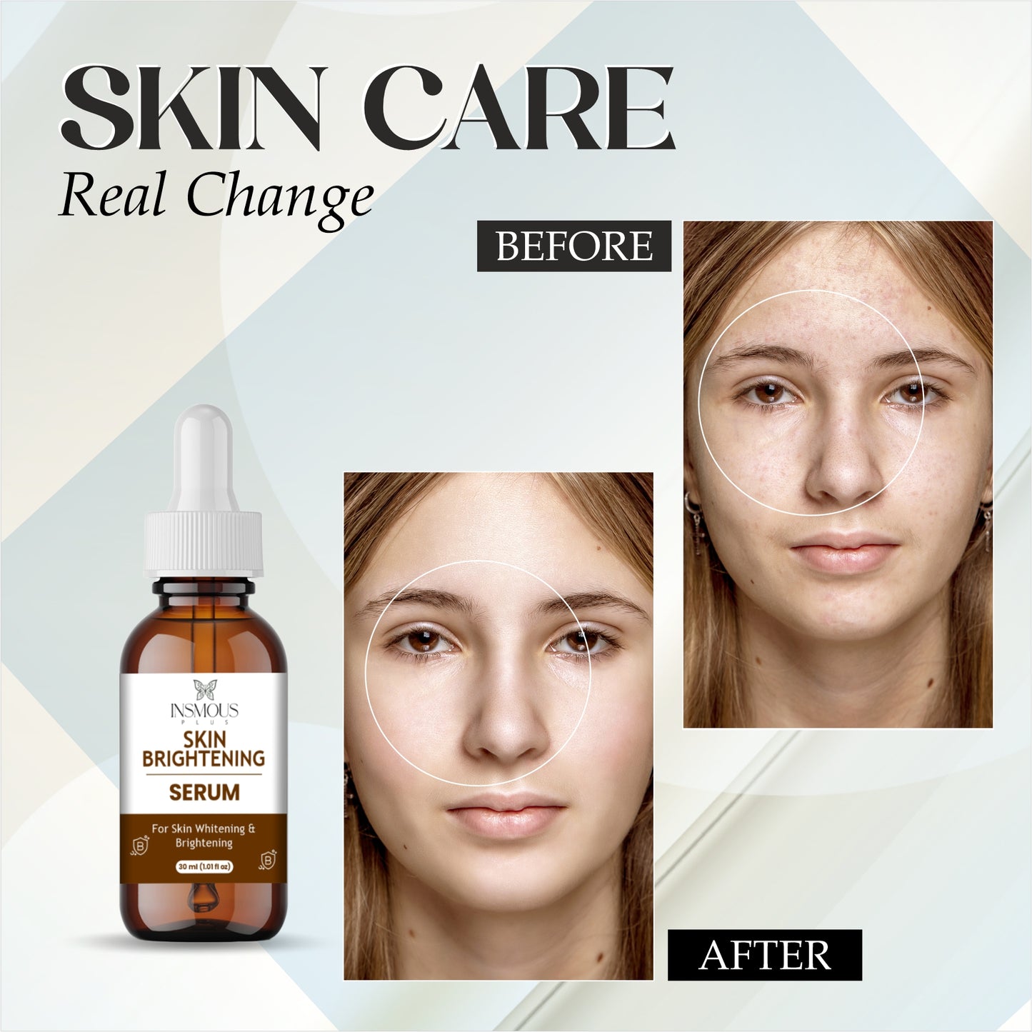 Radiance+ Skin Brightening Serum – Vitamin C, Hyaluronic Acid & Niacinamide | Dark Spot Corrector | Anti-Aging, Hydrating & Brightening Face Serum for Glowing Skin | 30ml