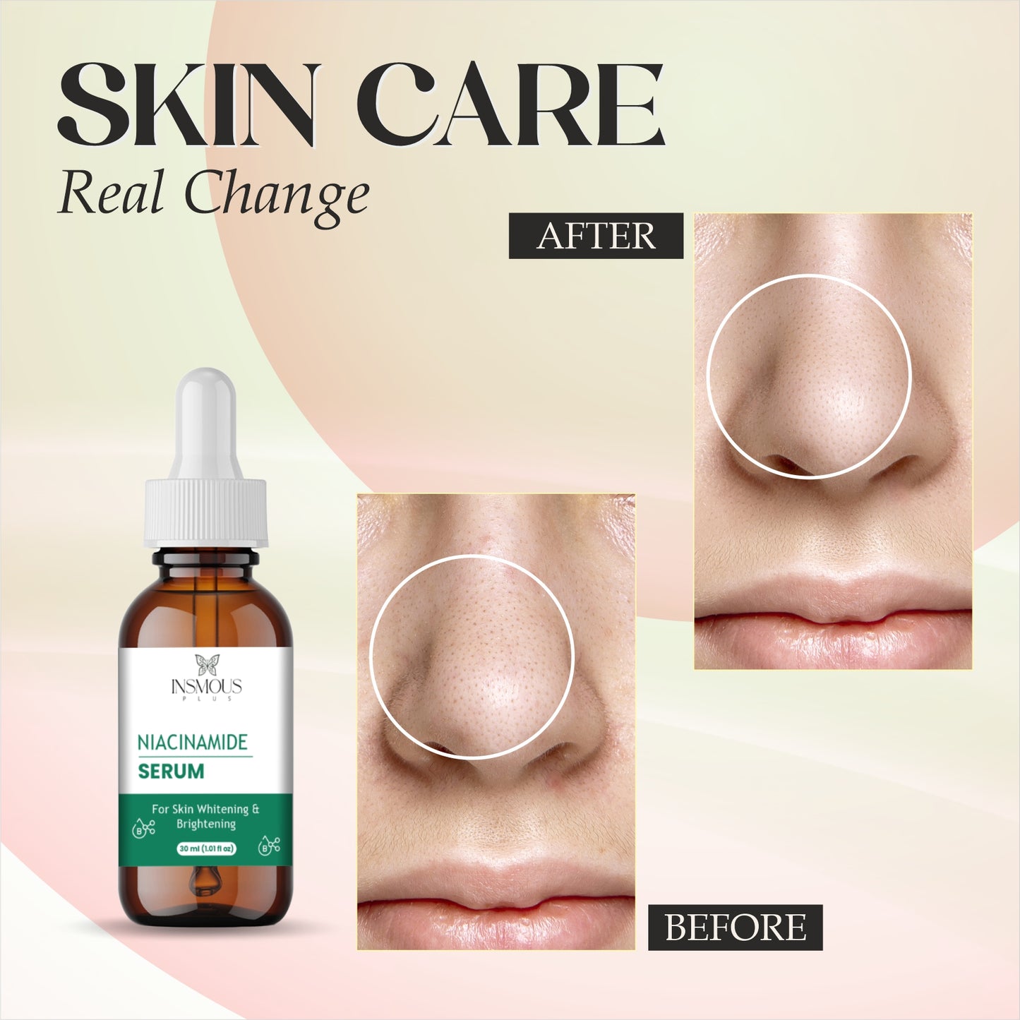 Niacinamide Serum 10% + Zinc 1% – Face Serum for Pore Minimizing, Oil Control & Even Skin Tone – Hydrating Anti-Aging Formula for Oily, Acne-Prone & Sensitive Skin